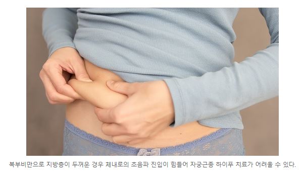 복부비만.JPG