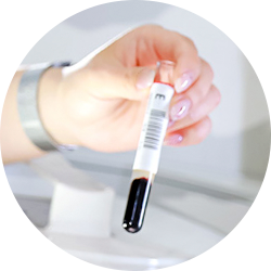 Ovarian diagnosis 04 01