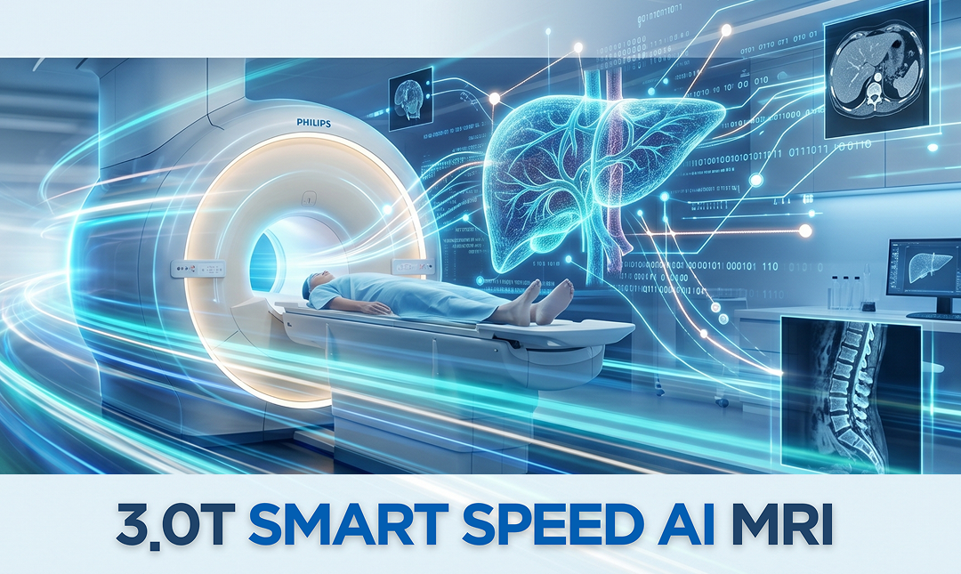 AI SmartSpeed MRI 도입