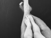 정계정맥류가 있으면 불임이다?
